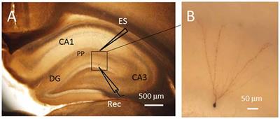 Synaptic Homeostasis and Allostasis in the Dentate Gyrus Caused by Inflammatory and Neuropathic Pain Conditions